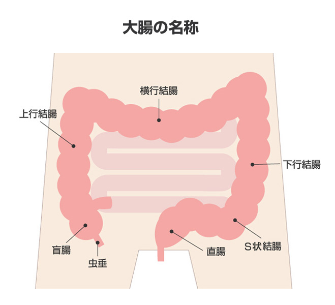 大腸がんの名称